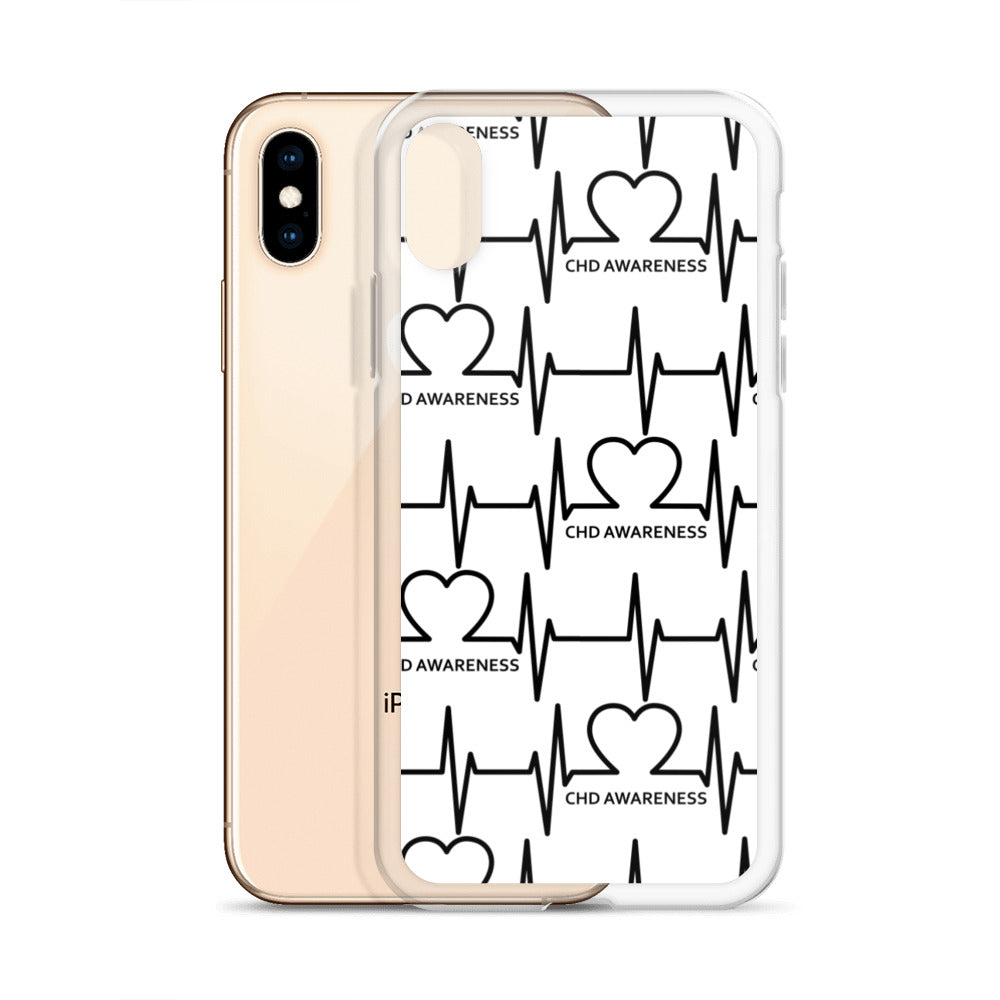 EKG - iPhone Case
